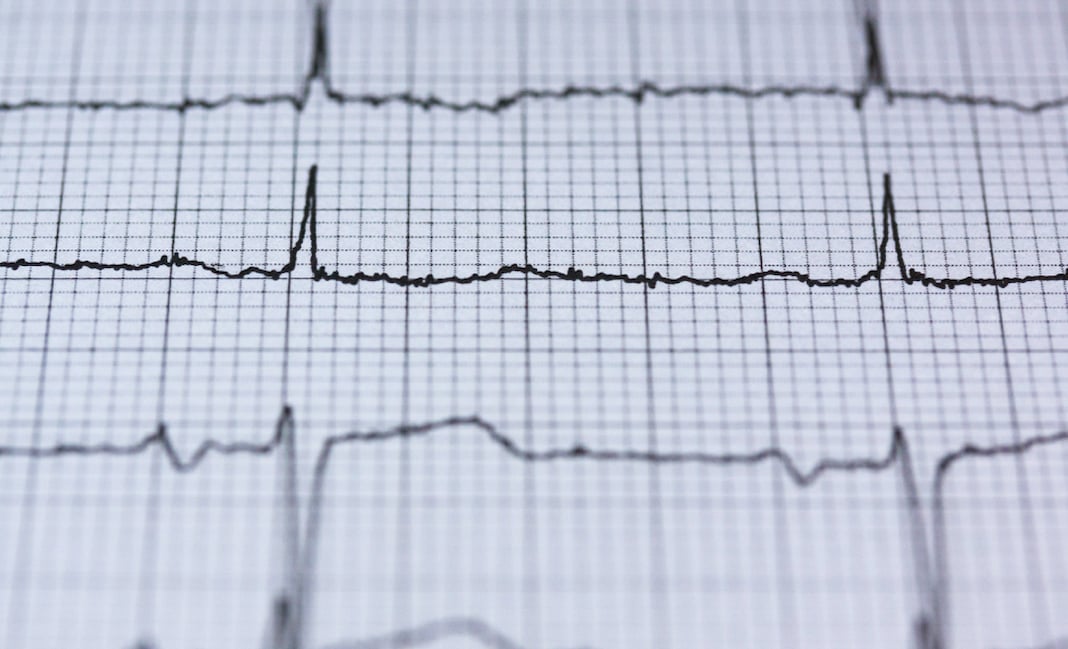Avoiding heart attacks: a bittersweet tale