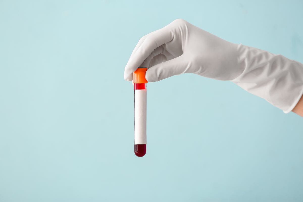 The ultimate guide to understanding your cholesterol panel and metabolic blood tests