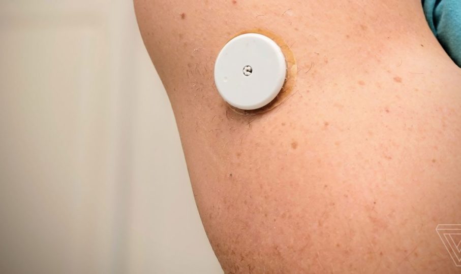 Levels Health Review: Optimize Your Fitness with a $400 Glucose Tracker