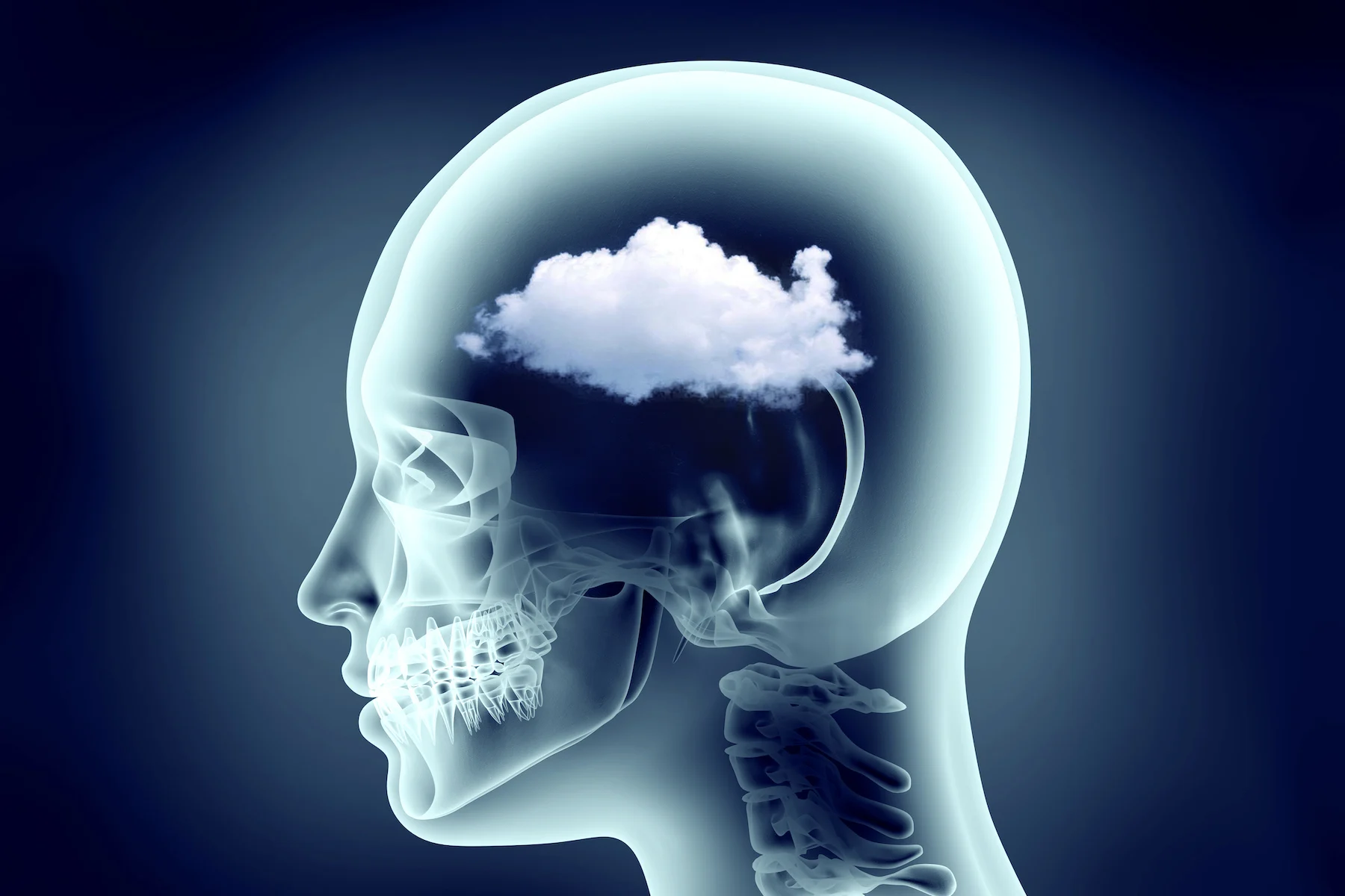 What causes brain fog? The metabolic health connection