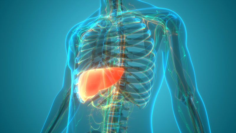Image of fatty liver