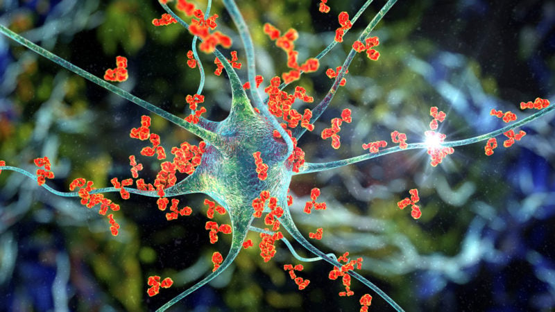 Immune attacking neuron