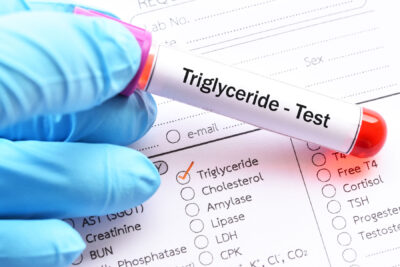Triglycerides Test Tube