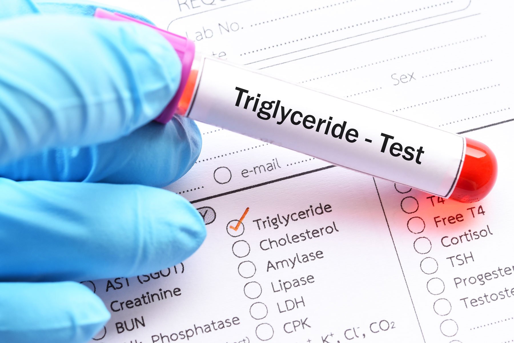 Why are triglycerides so important to metabolic health?